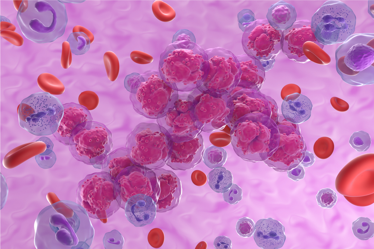 Leukemia
