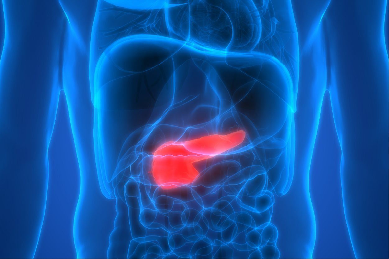 Pancreatic Cancer