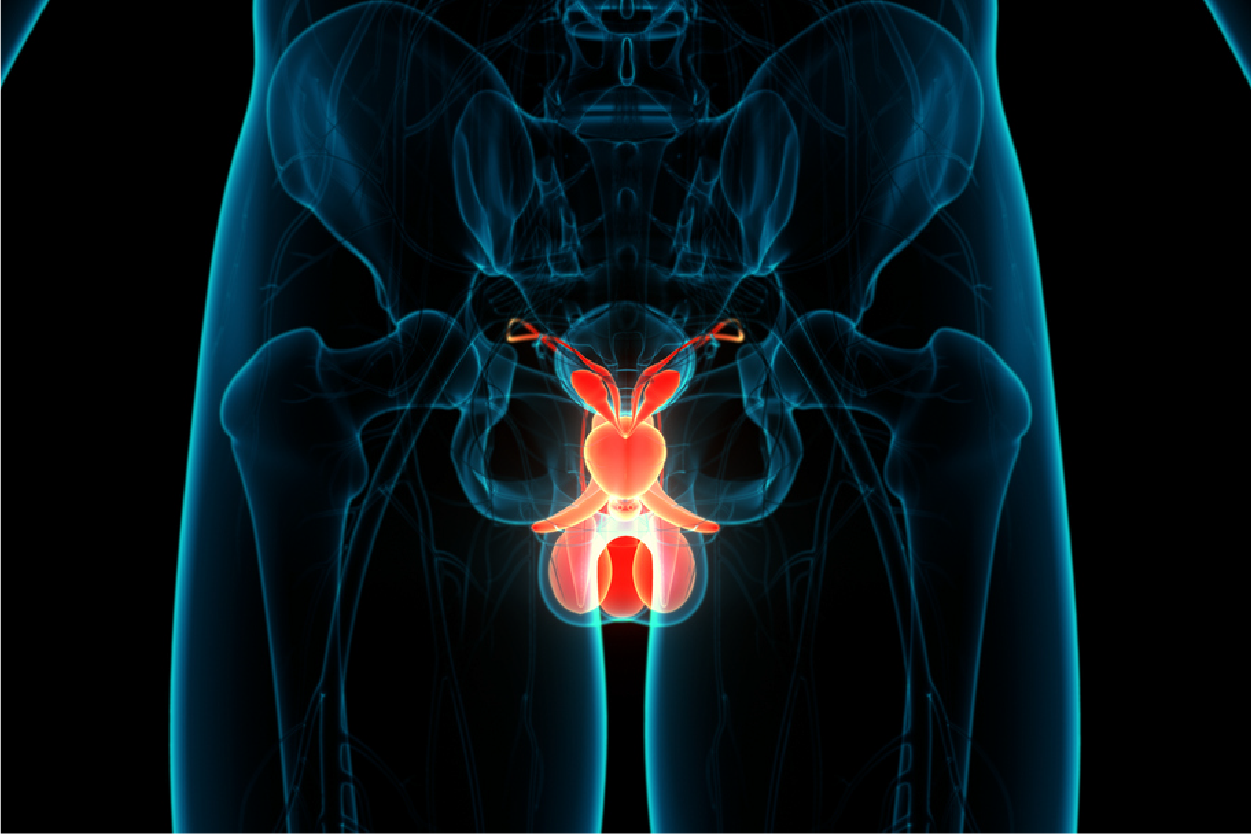 Prostate Cancer