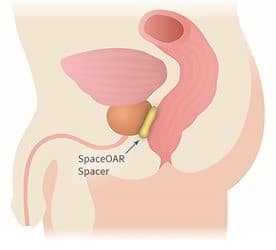 Prostate